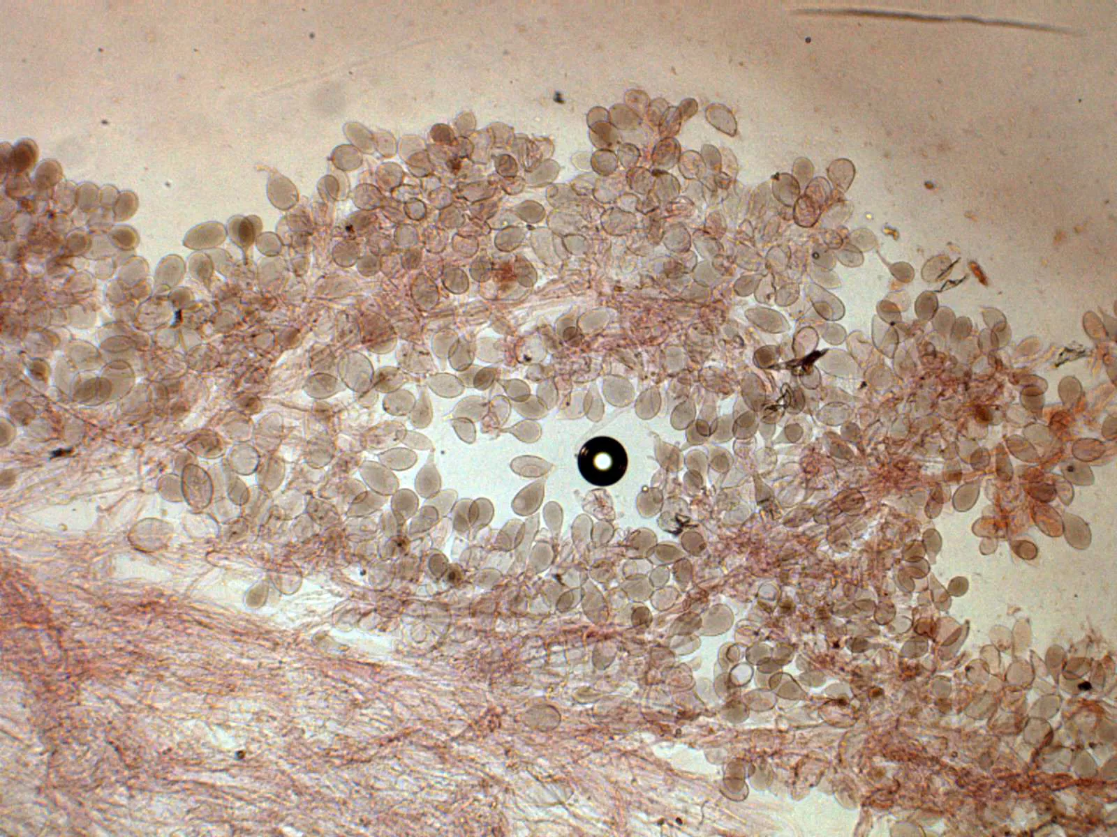 Microscopía de Pluteus luctuosus - 12 - Suprapellis x 100